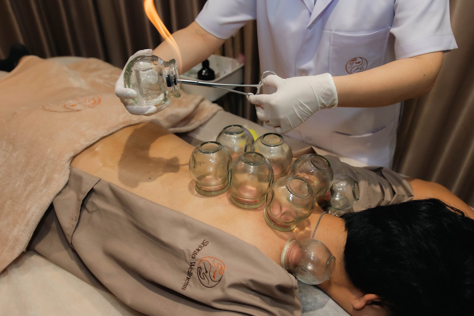 Cupping therapy